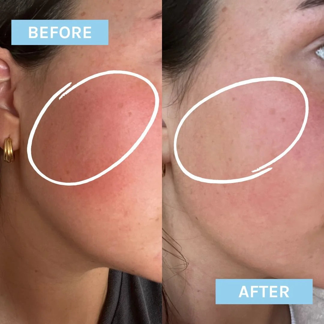 Evolve Blue Velvet Ceramide Serum
