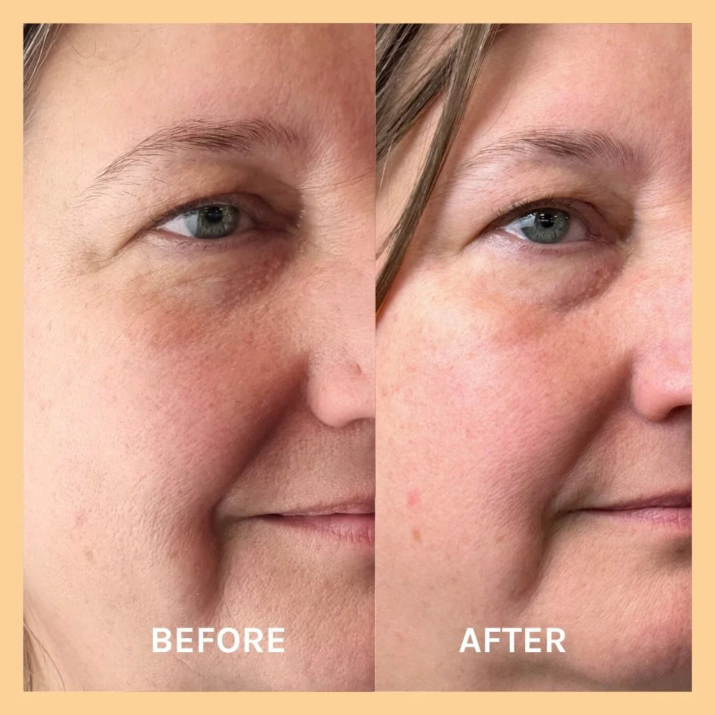 Evolve Miracle Vitamin C Mask