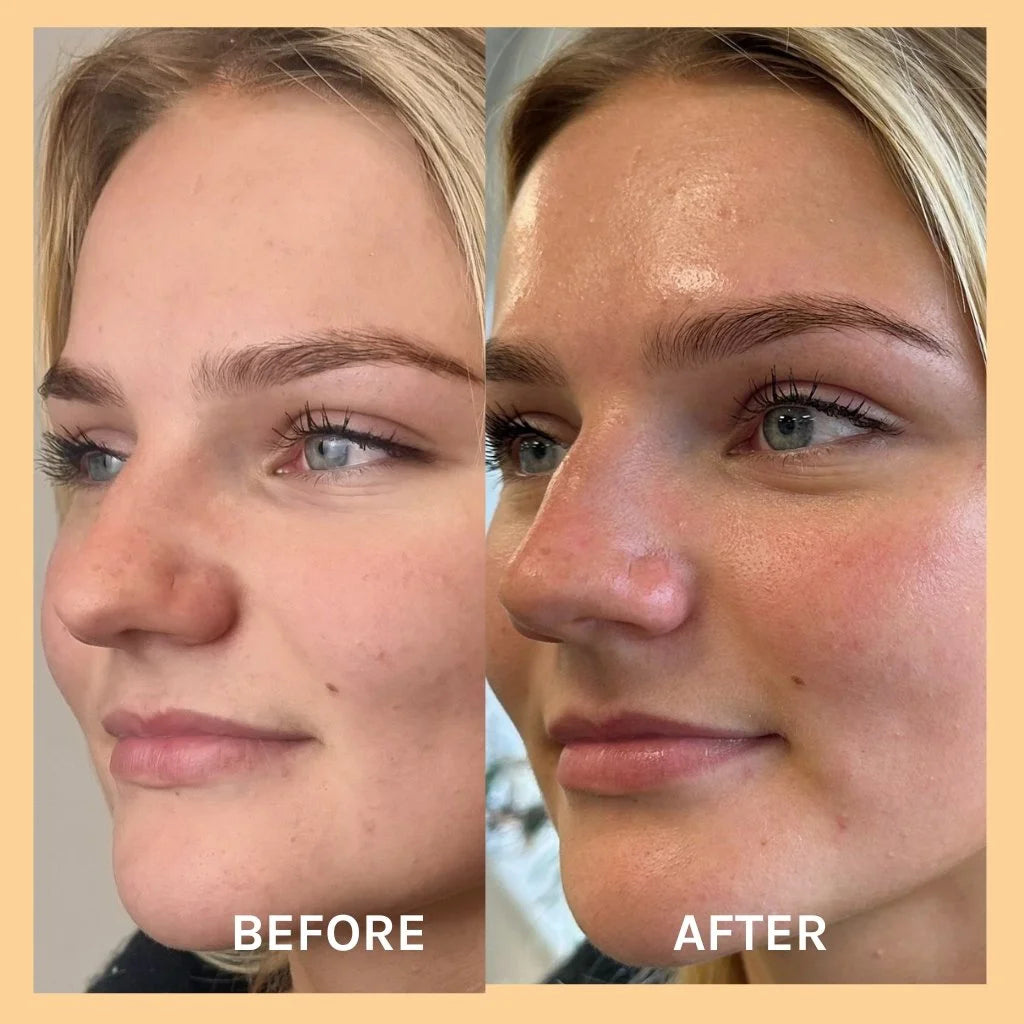 Evolve Miracle Vitamin C Mask