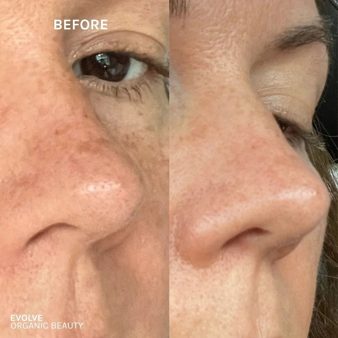 Evolve Resveratrol + Niacinamide Serum