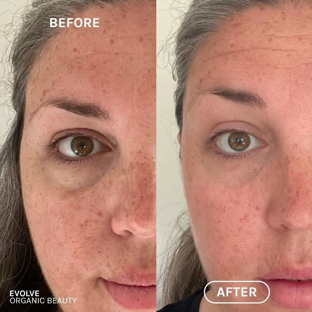 Evolve Resveratrol + Niacinamide Serum